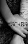 The book cover of Scars, by Cheryl Rainfield