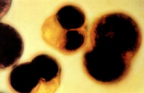 photomicrograph shows two tetrads and one dyad.