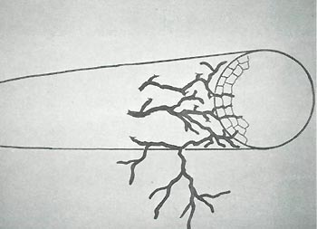 Root showing mycorrhia fungus