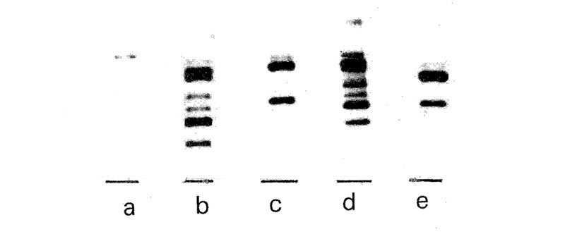 Figure 1: DNA fingerprints of five 
rhododendrons