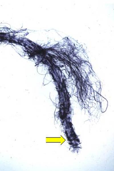 Rhododendron root colonized by H. ericae