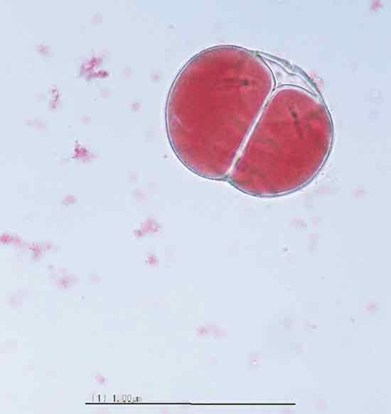 Figure 2. Photomicrograph of dyad
pollen grain of the triploid Rhododendron 'Red Wing'