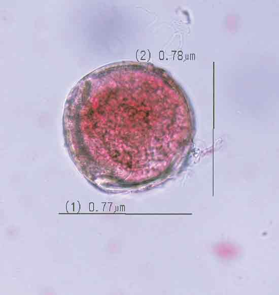 Figure 3. Photomicrograph of monad
pollen grain of the triploid Rhododendron 'Hallelujah'